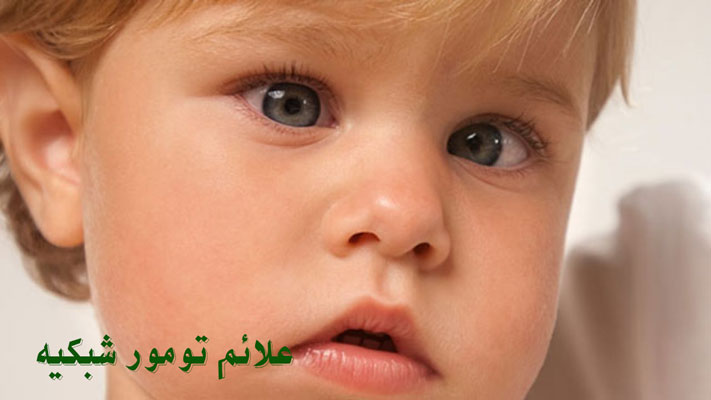علائم تومور شبکیه