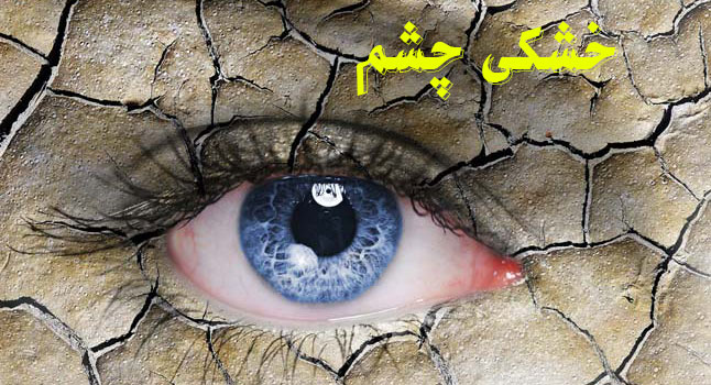 خشکی چشم