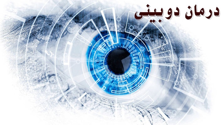 درمان دوبینی