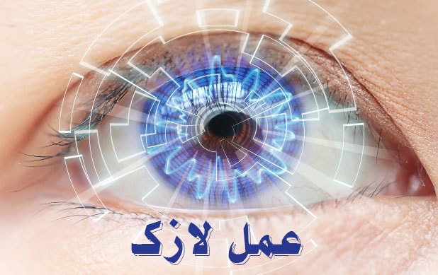 عمل لازک