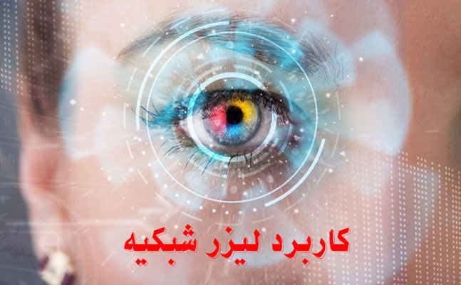 کاربرد لیزر شبکیه