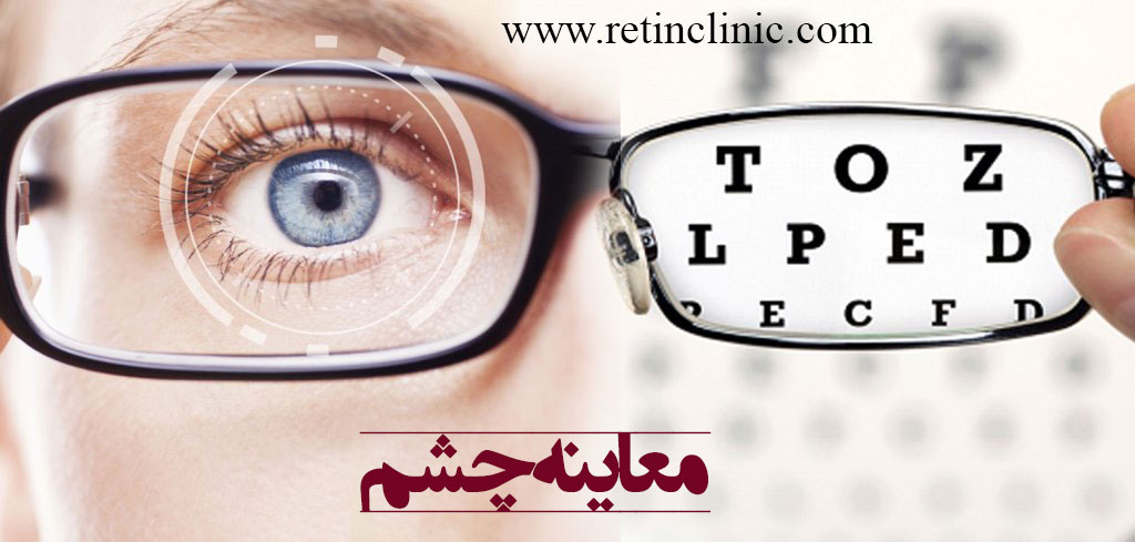 معاینه چشم